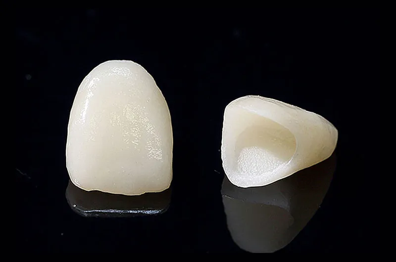 セラミック治療のメリット・デメリット