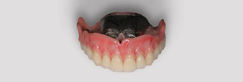 歯科技工士 奥森 健史 施術イメージ2