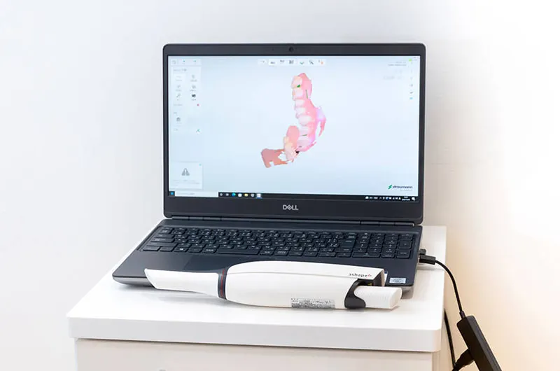 口腔内スキャナー