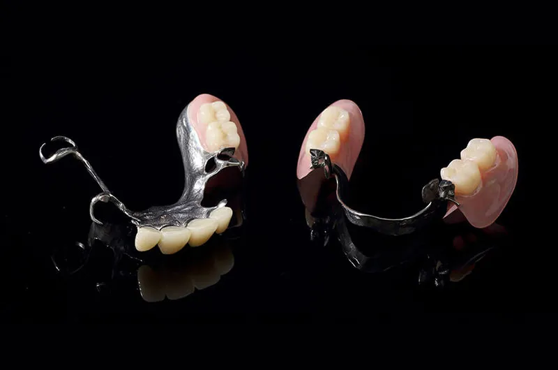 部分床の入れ歯