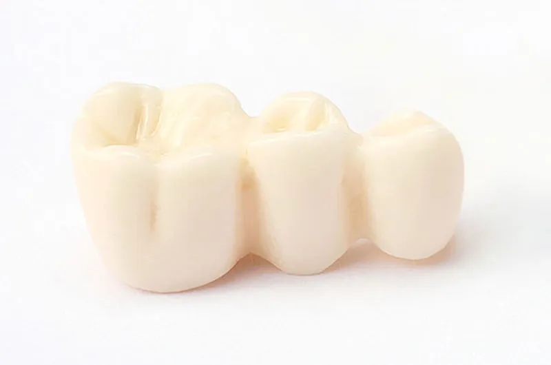 ブリッジについて