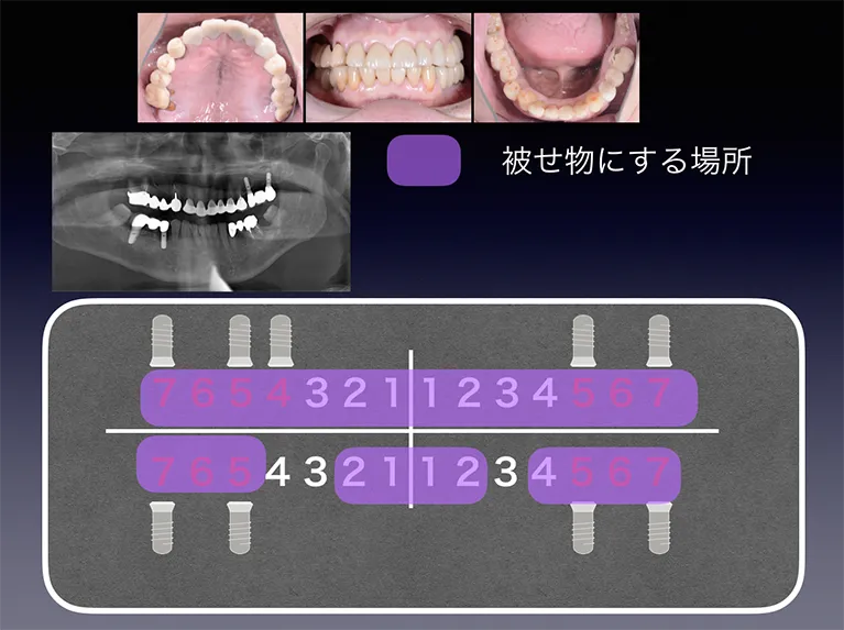 診断、治療計画の立案と説明、ご同意