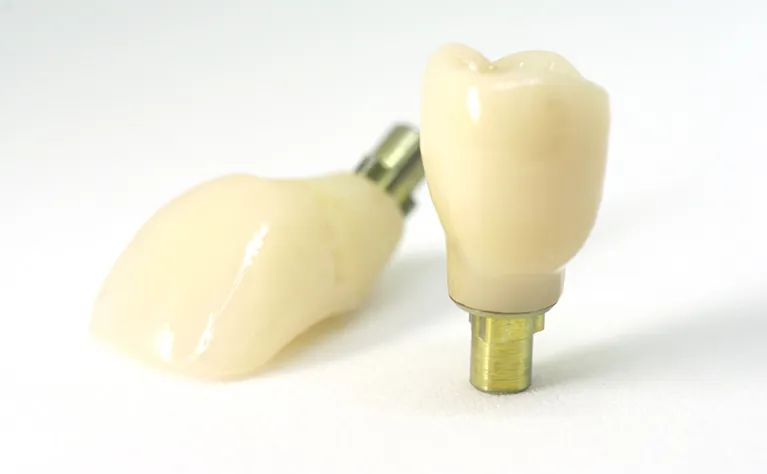 上部構造の設置